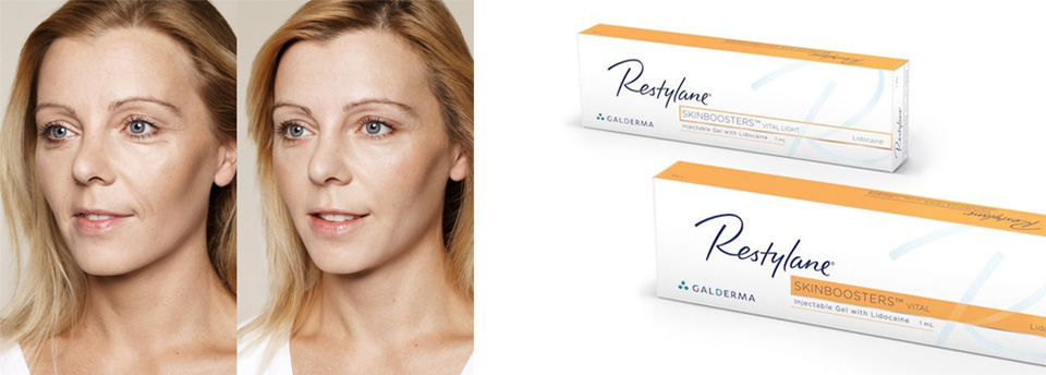 Restylane skinboosters